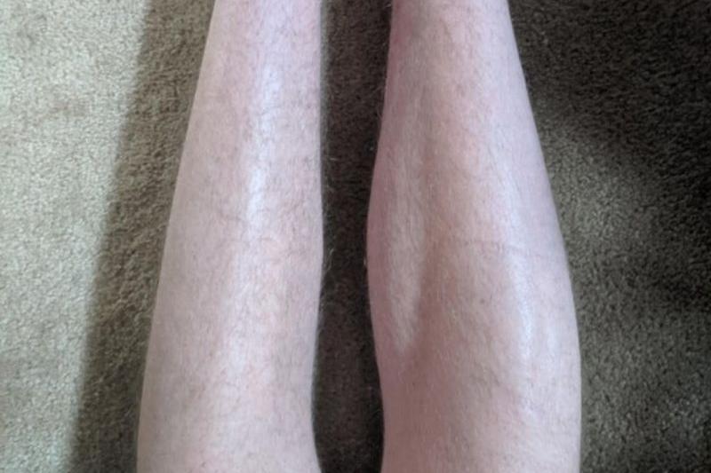Comparison Photos That Changed Our Perspectives – This Will Make You Stop and Think