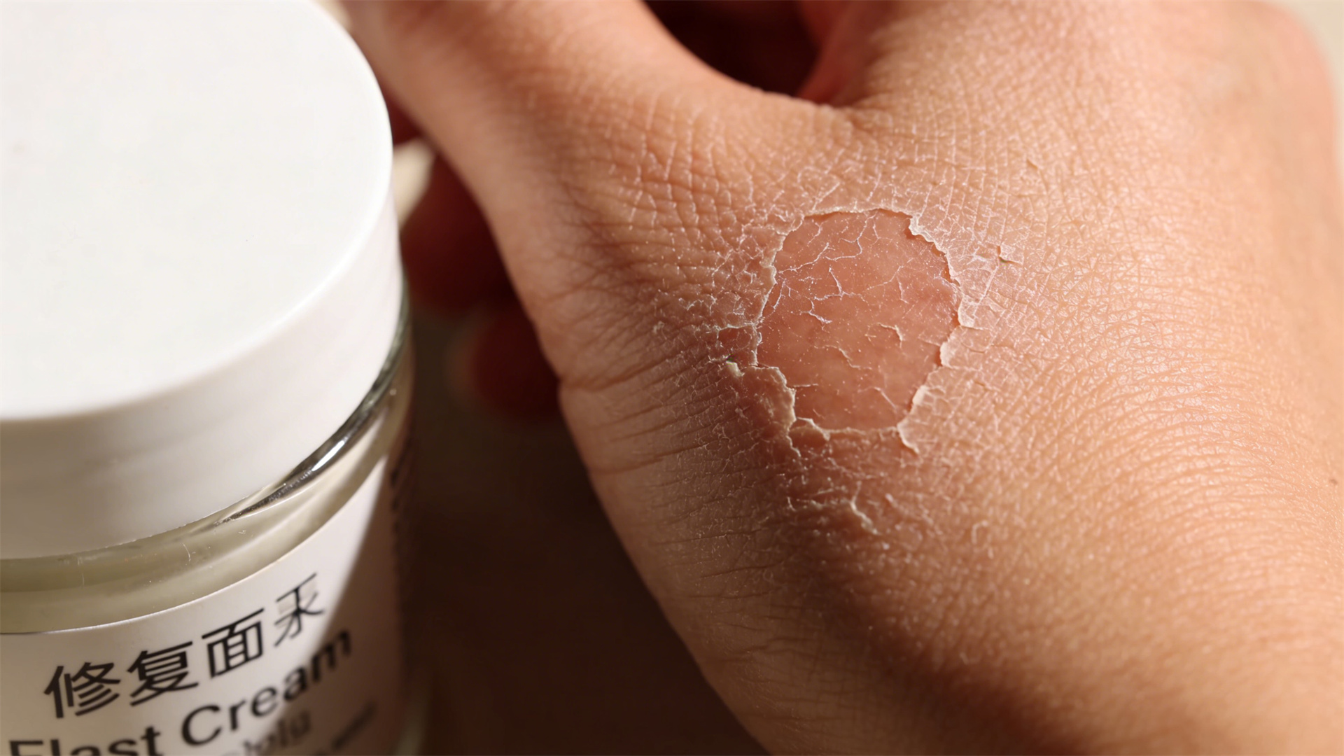 How Stress Manifests and Holistic Approaches to Clear Skin