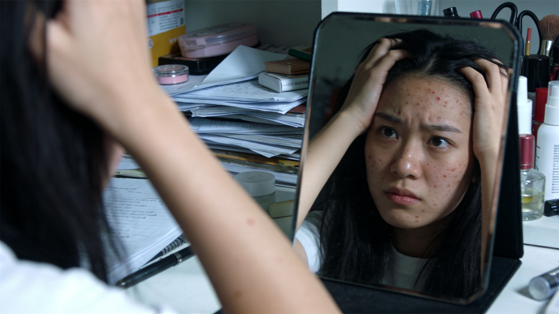 How Stress Manifests and Holistic Approaches to Clear Skin